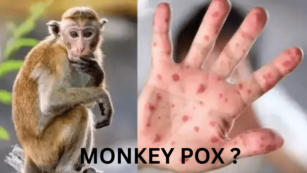 MPOX